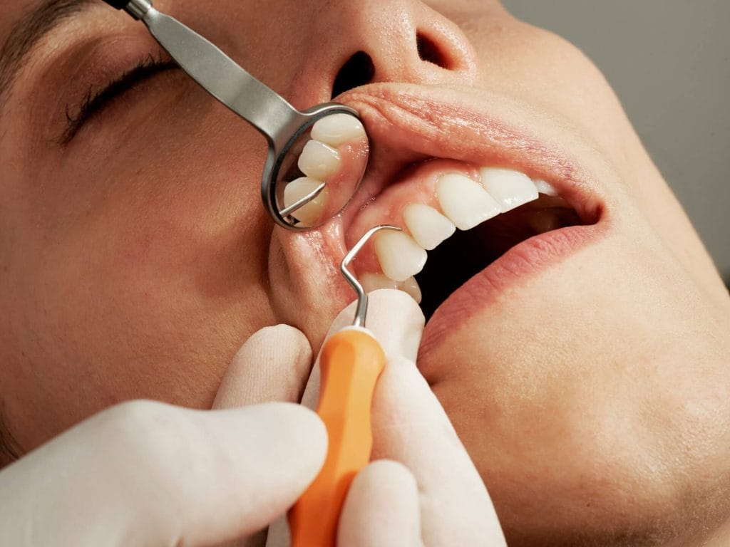 Quali sono le fasi dell'igiene dentale?
