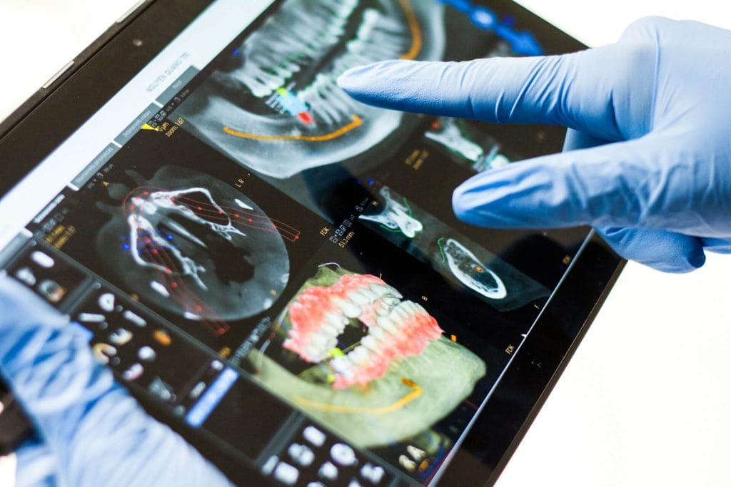Impronte dentali digitali i vantaggi